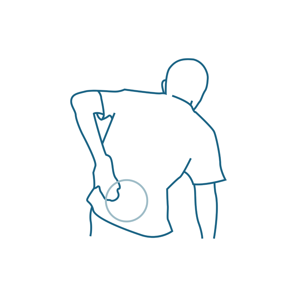 פריצת דיסק מותני